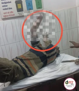 BOKARO STEEL PLANT ACCIDENT